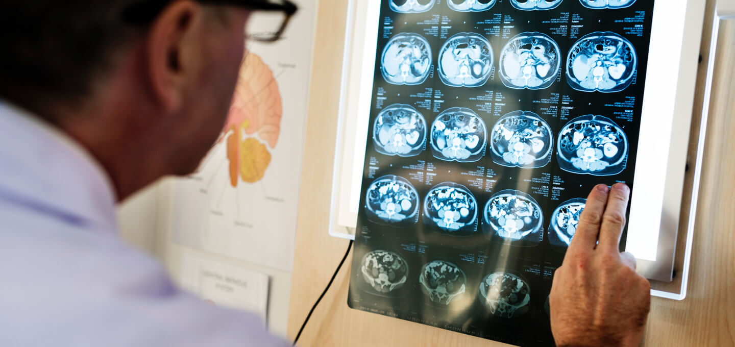 World-first brain imaging study to shed light on mind blindness